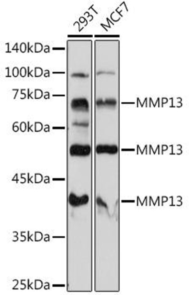 Cell Biology Antibodies 2 Anti-MMP13 Antibody CAB11755