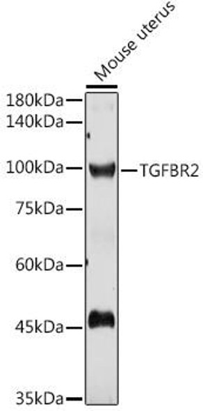 Cell Death Antibodies 1 Anti-TGFBR2 Antibody CAB11788