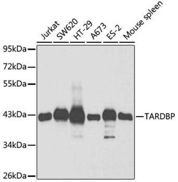 Cell Biology Antibodies 2 Anti-TARDBP Antibody CAB1183