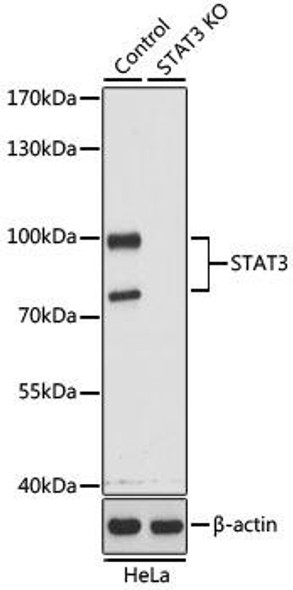 KO Validated Antibodies 1 Anti-STAT3 Antibody CAB1192KO Validated