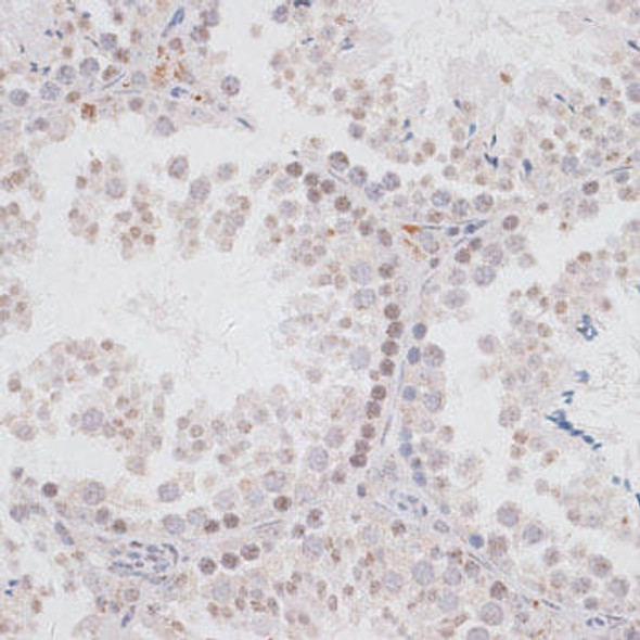 Developmental Biology Anti-KDM3A Antibody CAB11960