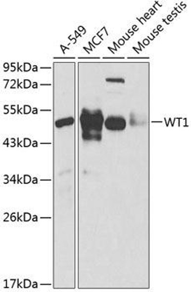 Epigenetics and Nuclear Signaling Antibodies 1 Anti-WT1 Antibody CAB1198