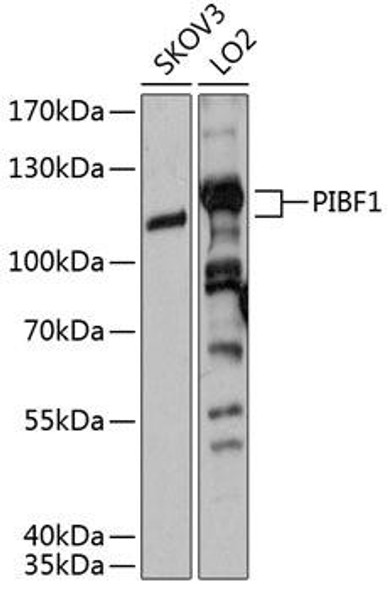 Immunology Antibodies 1 Anti-PIBF1 Antibody CAB12033