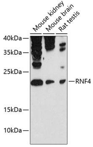 Epigenetics and Nuclear Signaling Antibodies 1 Anti-RNF4 Antibody CAB12037