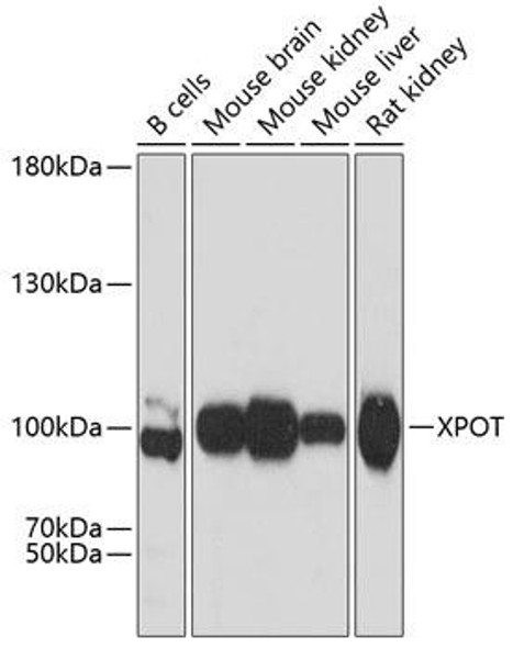 Signal Transduction Antibodies 1 Anti-XPOT Antibody CAB12043