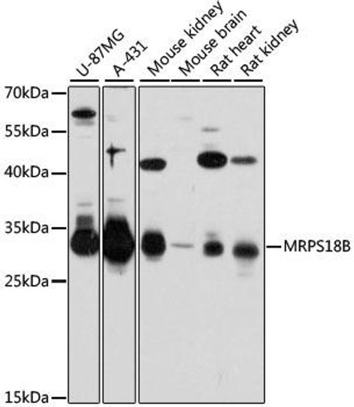 Cell Biology Antibodies 2 Anti-MRPS18B Antibody CAB12085