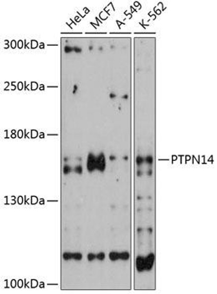 Epigenetics and Nuclear Signaling Antibodies 1 Anti-PTPN14 Antibody CAB12093