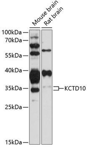 Signal Transduction Antibodies 1 Anti-KCTD10 Antibody CAB12115