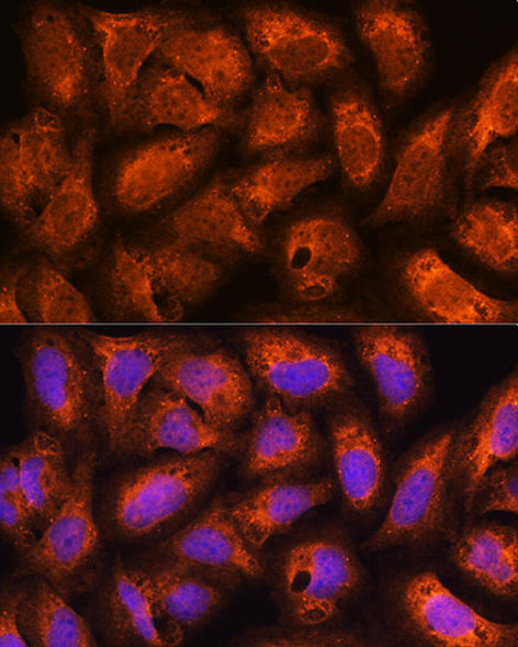 Cell Biology Antibodies 2 Anti-ACAP2 Antibody CAB12127