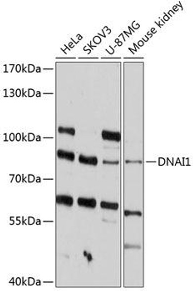 Cell Biology Antibodies 2 Anti-DNAI1 Antibody CAB12130