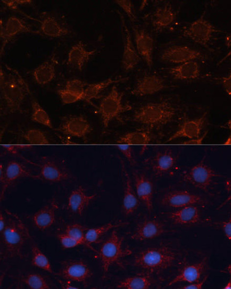 Signal Transduction Antibodies 1 Anti-SLC25A24 Antibody CAB12138