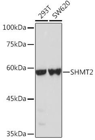 KO Validated Antibodies 1 Anti-SHMT2 Antibody CAB1215KO Validated
