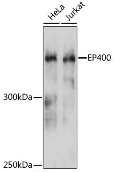 Cell Biology Antibodies 2 Anti-EP400 Antibody CAB12151