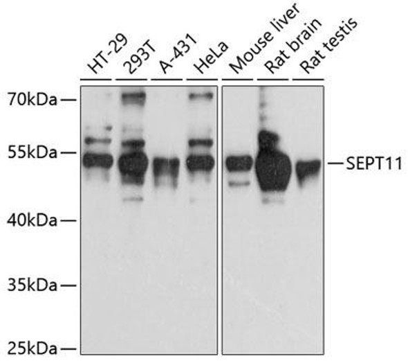 Cell Cycle Antibodies 1 Anti-SEPT11 Antibody CAB12189