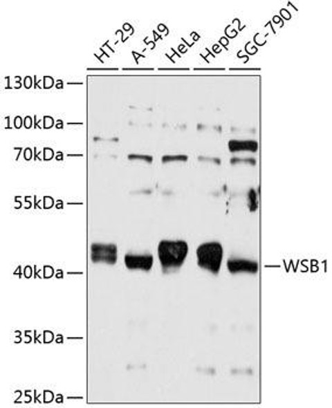 Signal Transduction Antibodies 1 Anti-WSB1 Antibody CAB12195