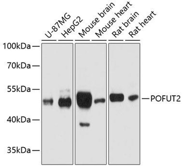 Metabolism Antibodies 1 Anti-POFUT2 Antibody CAB12223