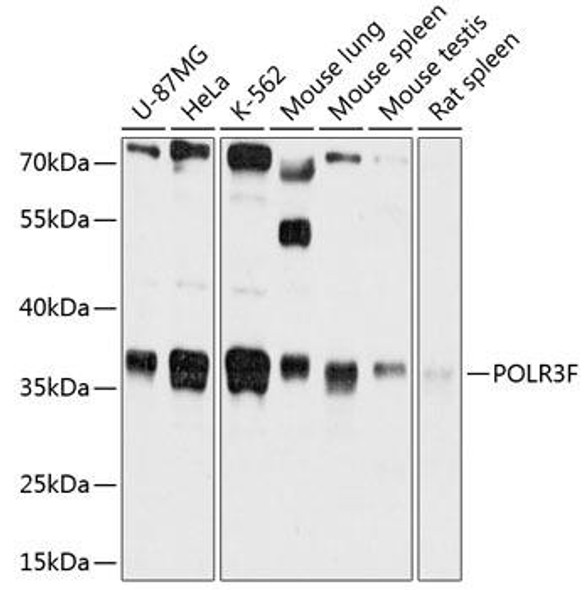 Immunology Antibodies 1 Anti-POLR3F Antibody CAB12224