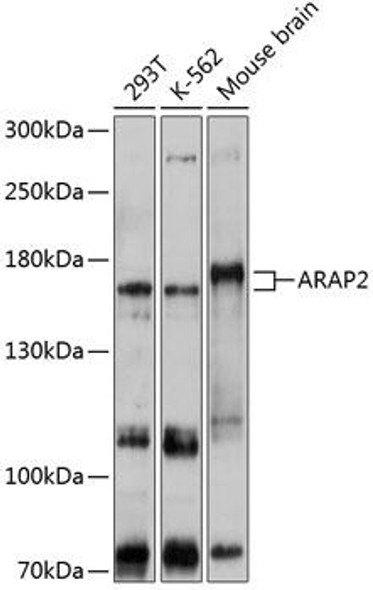 Cell Biology Antibodies 2 Anti-ARAP2 Antibody CAB12254