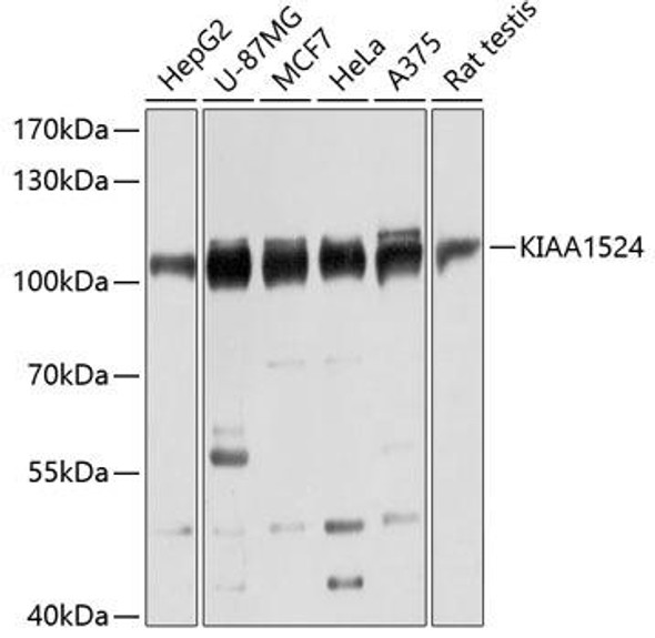 Cell Biology Antibodies 2 Anti-KIAA1524 Antibody CAB12267