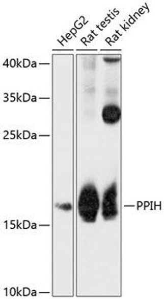 Epigenetics and Nuclear Signaling Antibodies 1 Anti-PPIH Antibody CAB12274
