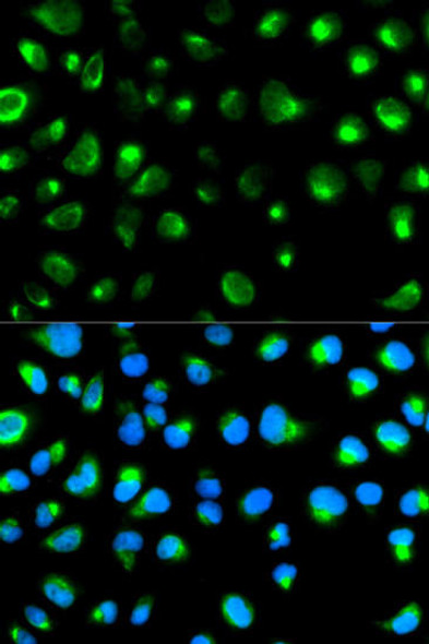 Cell Biology Antibodies 2 Anti-GYPC Antibody CAB1232