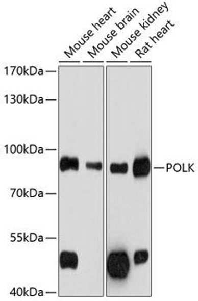 Epigenetics and Nuclear Signaling Antibodies 1 Anti-POLK Antibody CAB12333