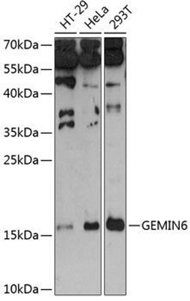 Epigenetics and Nuclear Signaling Antibodies 1 Anti-GEMIN6 Antibody CAB12375