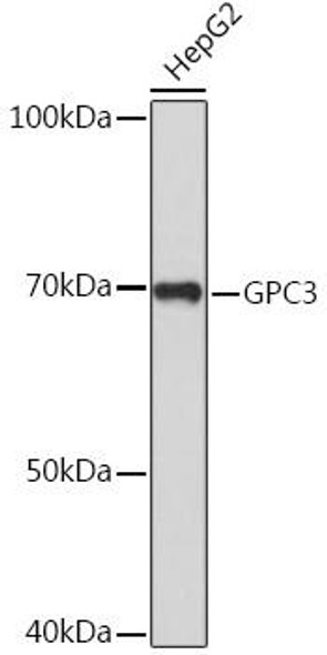 Cell Biology Antibodies 2 Anti-GPC3 Antibody CAB12383