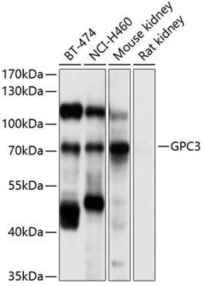 Cell Biology Antibodies 2 Anti-GPC3 Antibody CAB12384