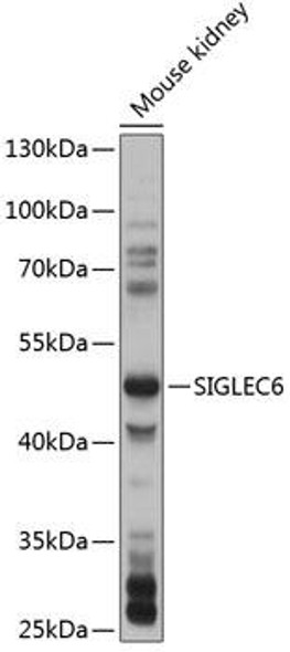 Cell Biology Antibodies 3 Anti-SIGLEC6 Antibody CAB12387