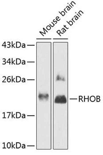 Cardiovascular Antibodies Anti-RHOB Antibody CAB12402