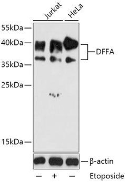 Cell Death Antibodies 1 Anti-DFFA Antibody CAB12431
