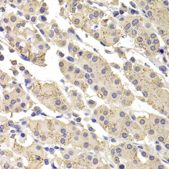 Cell Death Antibodies 1 Anti-DFFA Antibody CAB12431