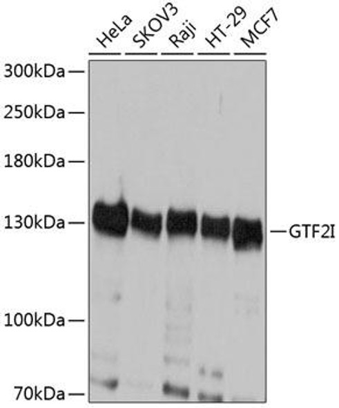 Epigenetics and Nuclear Signaling Antibodies 1 Anti-GTF2I Antibody CAB12441