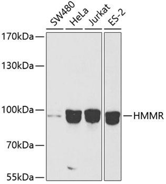 KO Validated Antibodies 1 Anti-HMMR Antibody CAB12445KO Validated