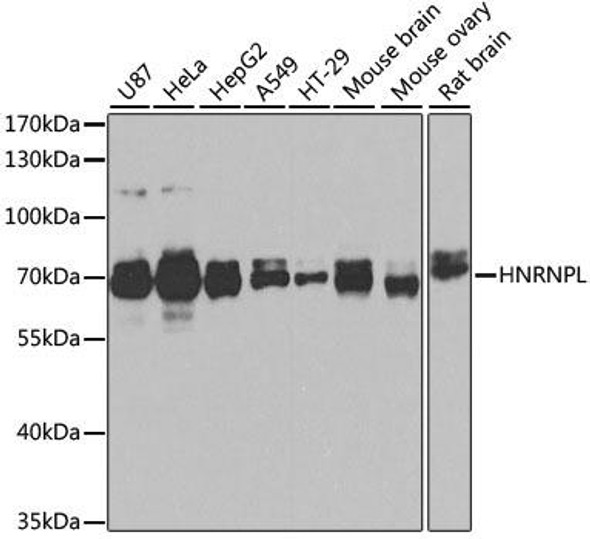 Cell Biology Antibodies 3 Anti-HNRNPL Antibody CAB12447