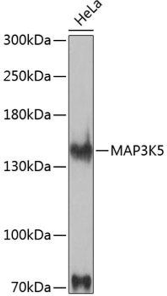 Cell Death Antibodies 1 Anti-MAP3K5 Antibody CAB12458