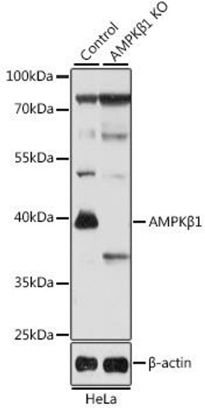 KO Validated Antibodies 1 Anti-AMPKBeta1 Antibody CAB12491KO Validated