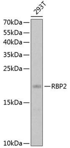 Signal Transduction Antibodies 1 Anti-RBP2 Antibody CAB12494