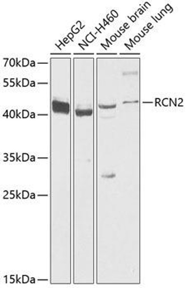 Cell Biology Antibodies 3 Anti-RCN2 Antibody CAB12496