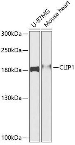 Signal Transduction Antibodies 1 Anti-CLIP1 Antibody CAB12498
