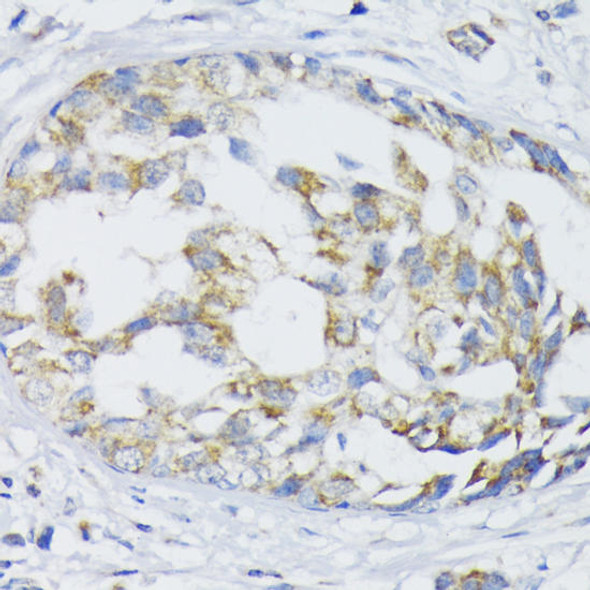 Signal Transduction Antibodies 1 Anti-SLC30A1 Antibody CAB12532