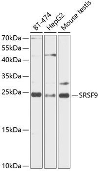 Epigenetics and Nuclear Signaling Antibodies 1 Anti-SFRS9 Antibody CAB12538