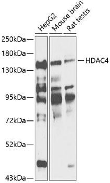 Epigenetics and Nuclear Signaling Antibodies 1 Anti-HDAC4 Antibody CAB12552