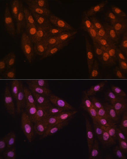 Cell Cycle Antibodies 1 Anti-MAD2L2 Antibody CAB12559