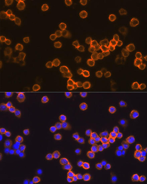 Immunology Antibodies 1 Anti-EMR1 Antibody CAB1256