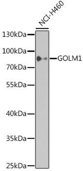 Cell Biology Antibodies 3 Anti-GOLM1 Antibody CAB12584
