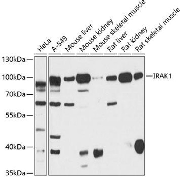 Immunology Antibodies 1 Anti-IRAK1 Antibody CAB12624