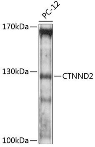 Cell Biology Antibodies 3 Anti-CTNND2 Antibody CAB12633