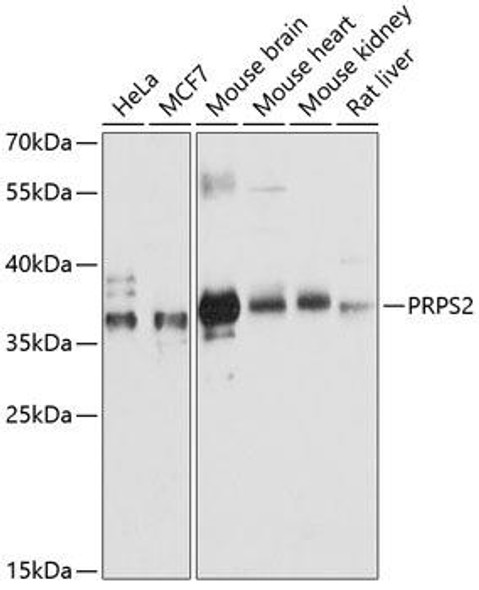 Epigenetics and Nuclear Signaling Antibodies 1 Anti-PRPS2 Antibody CAB12644